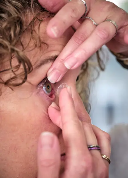 pose lentilles de contact